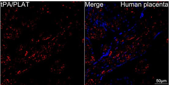 Confocal imaging of human placenta using tPA/PLAT Rabbit mAb at dilution of 1:100) (Red). DAPI was used for nuclear staining (blue). Objective: 40x. Perform high pressure antigen retrieval with 10 mM citrate buffer pH 6.0 before commencing with IF staining protocol.