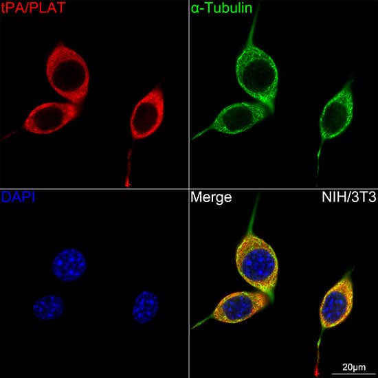 Immunocytochemistry/ Immunofluorescence: t-Plasminogen Activator/tPA Antibody (10W4L1) [NBP3-16356] - Confocal imaging of NIH/3T3 cells using t-Plasminogen Activator/tPA Rabbit mAb . The cells were counterstained with alpha-Tubulin Mouse mAb (Green). DAPI was used for nuclear staining (blue). Objective: 100x.