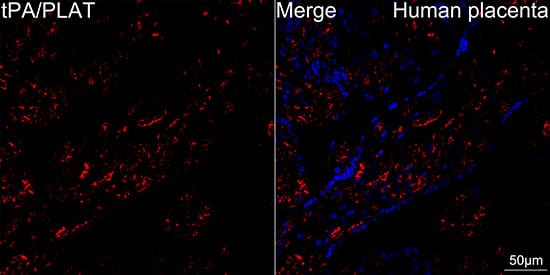 Immunocytochemistry/ Immunofluorescence: t-Plasminogen Activator/tPA Antibody (10W4L1) [NBP3-16356] - Confocal imaging of human placenta using t-Plasminogen Activator/tPA Rabbit mAb . DAPI was used for nuclear staining (blue). Objective: 40x. Perform high pressure antigen retrieval with 10 mM citrate buffer pH 6.0 before commencing with IF staining protocol.