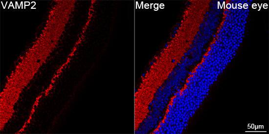 Immunocytochemistry/ Immunofluorescence: VAMP-2 Antibody (8X9D9) [NBP3-16362] - Confocal imaging of paraffin-embedded Mouse eye using VAMP-2 Rabbit mAb  followed by a further incubation with Cy3 Goat Anti-Rabbit IgG (H+L).DAPI was used for nuclear staining (Blue). Objective: 40x. Perform high pressure antigen retrieval with 0.01 M citRate buffer (pH 6.0) prior to IF staining.