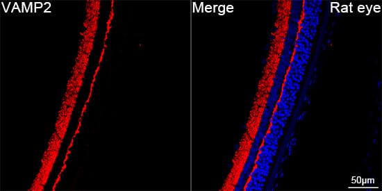 Immunocytochemistry/ Immunofluorescence: VAMP-2 Antibody (8X9D9) [NBP3-16362] - Confocal imaging of paraffin-embedded Rat eye using VAMP-2 Rabbit mAb  followed by a further incubation with Cy3 Goat Anti-Rabbit IgG (H+L).DAPI was used for nuclear staining (Blue). Objective: 40x. Perform high pressure antigen retrieval with 0.01 M citRate buffer (pH 6.0) prior to IF staining.