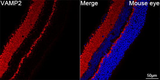 Immunocytochemistry/ Immunofluorescence: VAMP-2 Antibody (8X9D9) [VAMP-2] - Confocal imaging of paraffin-embedded Mouse eye  using VAMP-2 Rabbit mAb   followed by a further incubation with Cy3 Goat Anti-Rabbit IgG (H+L) .DAPI was used for nuclear staining (Blue). Objective: 40x. Perform high pressure antigen retrieval with 0.01 M citRate buffer (pH 6.0) prior to IF staining.