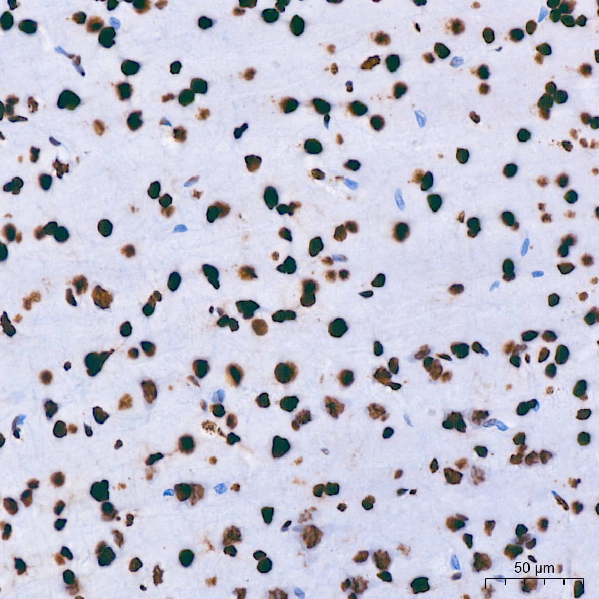 Immunohistochemistry: hnRNP U Antibody (3R3F1) [NBP3-16363] - Immunohistochemistry analysis of paraffin-embedded Rat brain using hnRNP U Rabbit mAb at dilution of 1:200 (40x lens). High pressure antigen retrieval performed with 0.01M Citrate Bufferr (pH 6.0) prior to IHC staining.