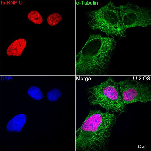 Immunocytochemistry/ Immunofluorescence: hnRNP U Antibody (3R3F1) [NBP3-16363] - Confocal imaging of U-2 0S cells using hnRNP U Rabbit mAb. The cells were counterstained with alpha-Tubulin Mouse mAb (Green). DAPI was used for nuclear staining (blue). Objective: 60x.