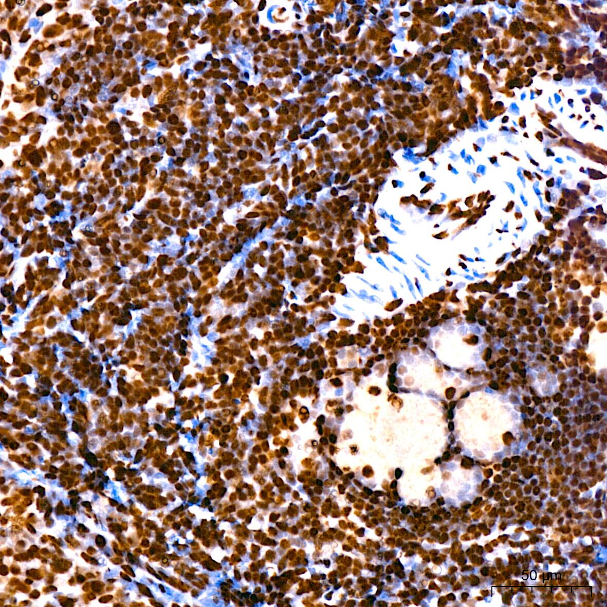 Immunohistochemistry: hnRNP U Antibody (3R3F1) [NBP3-16363] - Immunohistochemistry analysis of paraffin-embedded Rat spleen using hnRNP U Rabbit mAb at dilution of 1:200 (40x lens). High pressure antigen retrieval performed with 0.01M Citrate Bufferr (pH 6.0) prior to IHC staining.