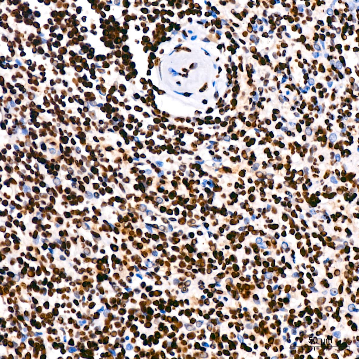Immunohistochemistry: hnRNP U Antibody (3R3F1) [NBP3-16363] - Immunohistochemistry analysis of paraffin-embedded Human spleen using hnRNP U Rabbit mAb at dilution of 1:200 (40x lens). High pressure antigen retrieval performed with 0.01M Citrate Bufferr (pH 6.0) prior to IHC staining.