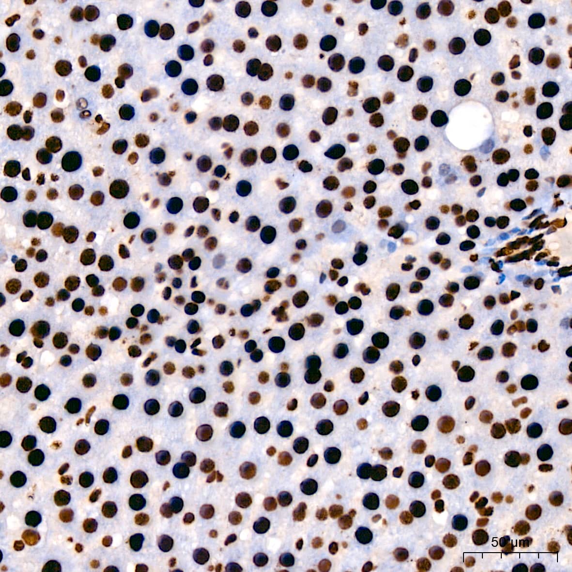 Immunohistochemistry: hnRNP U Antibody (3R3F1) [NBP3-16363] - Immunohistochemistry analysis of paraffin-embedded Rat liver using hnRNP U Rabbit mAb at dilution of 1:200 (40x lens). High pressure antigen retrieval performed with 0.01M Citrate Bufferr (pH 6.0) prior to IHC staining.