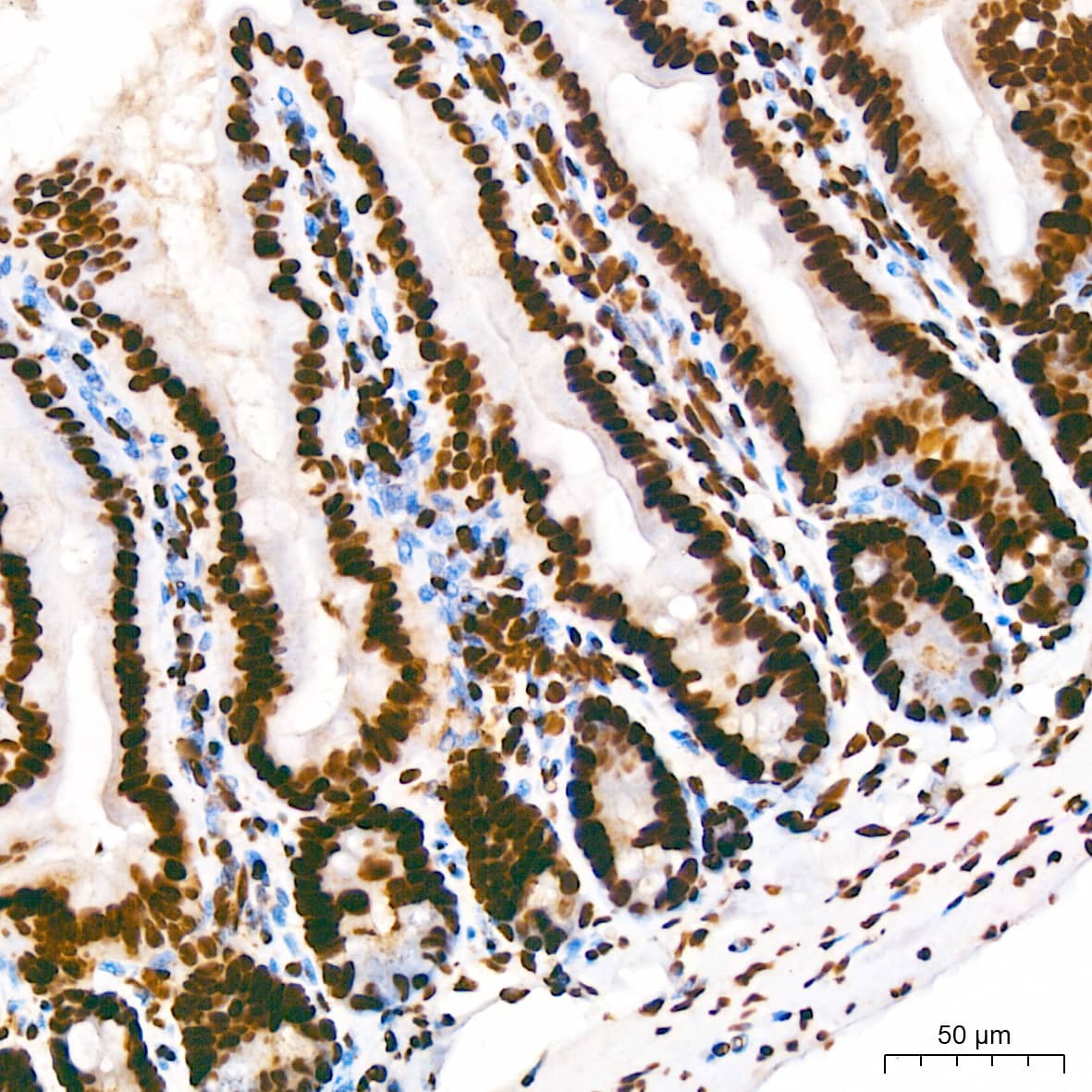 Immunohistochemistry: hnRNP U Antibody (3R3F1) [NBP3-16363] - Immunohistochemistry analysis of paraffin-embedded Mouse colon using hnRNP U Rabbit mAb at dilution of 1:200 (40x lens). High pressure antigen retrieval performed with 0.01M Citrate Bufferr (pH 6.0) prior to IHC staining.