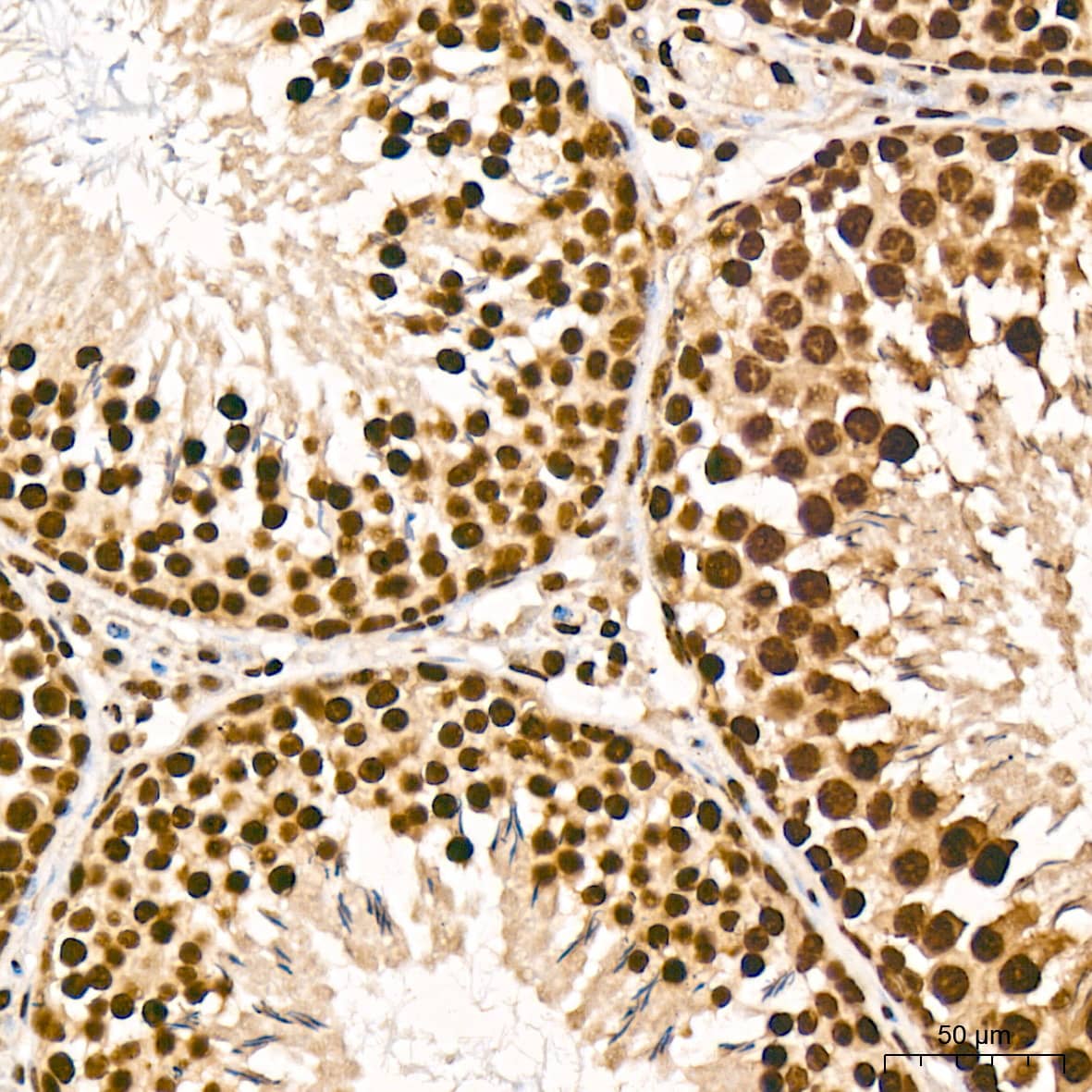 Immunohistochemistry Aly Antibody (6I4T10)