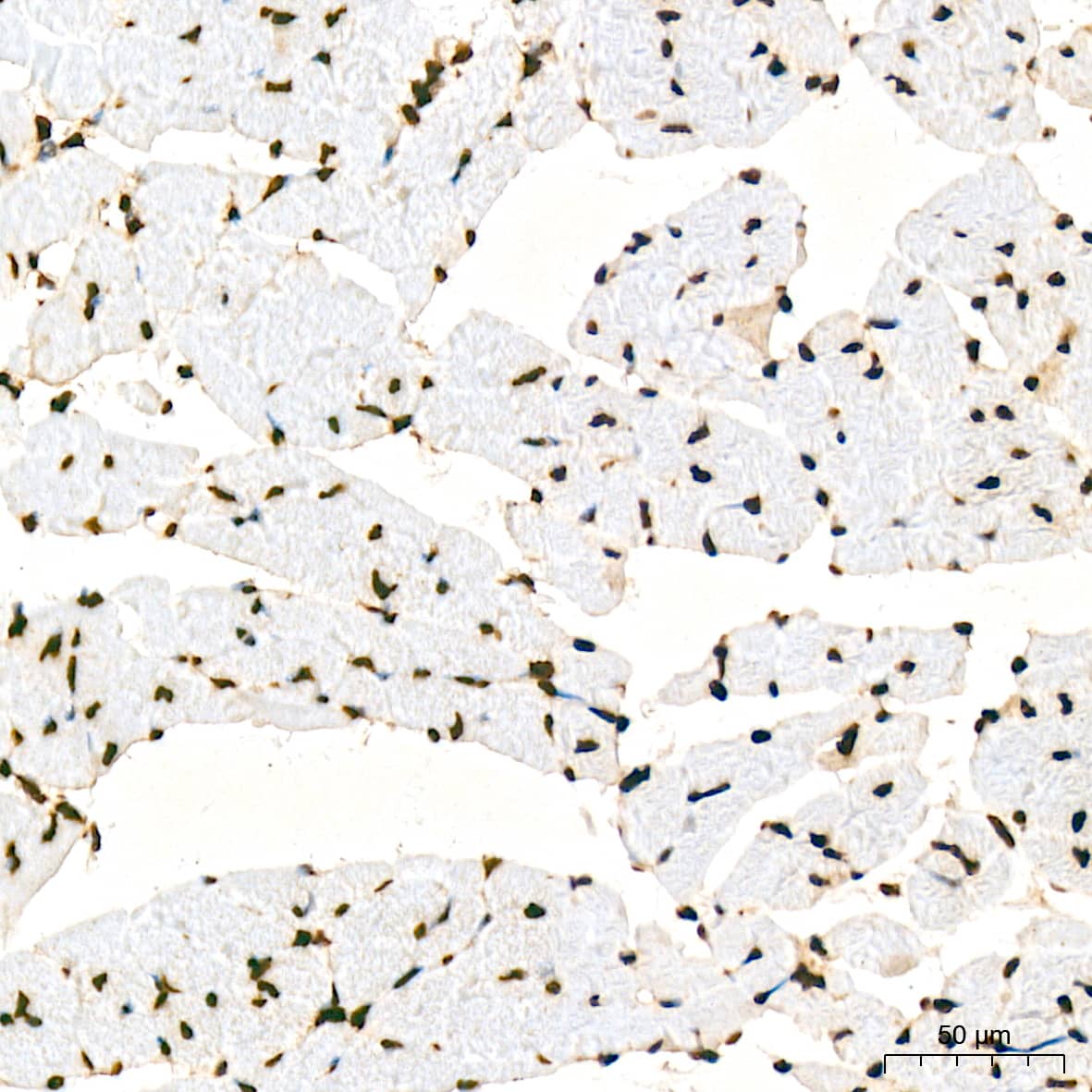 Immunohistochemistry Aly Antibody (6I4T10)