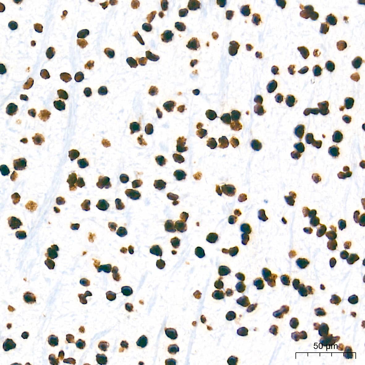 Immunohistochemistry: HMGA1 Antibody (5J0E6) [NBP3-16379] - Immunohistochemistry analysis of paraffin-embedded Mouse brain tissue using HMGA1 Rabbit mAb at a dilution of 1:5000 (40x lens). High pressure antigen retrieval performed with 0.01M Tris-EDTA Buffer (pH 9.0) prior to IHC staining.