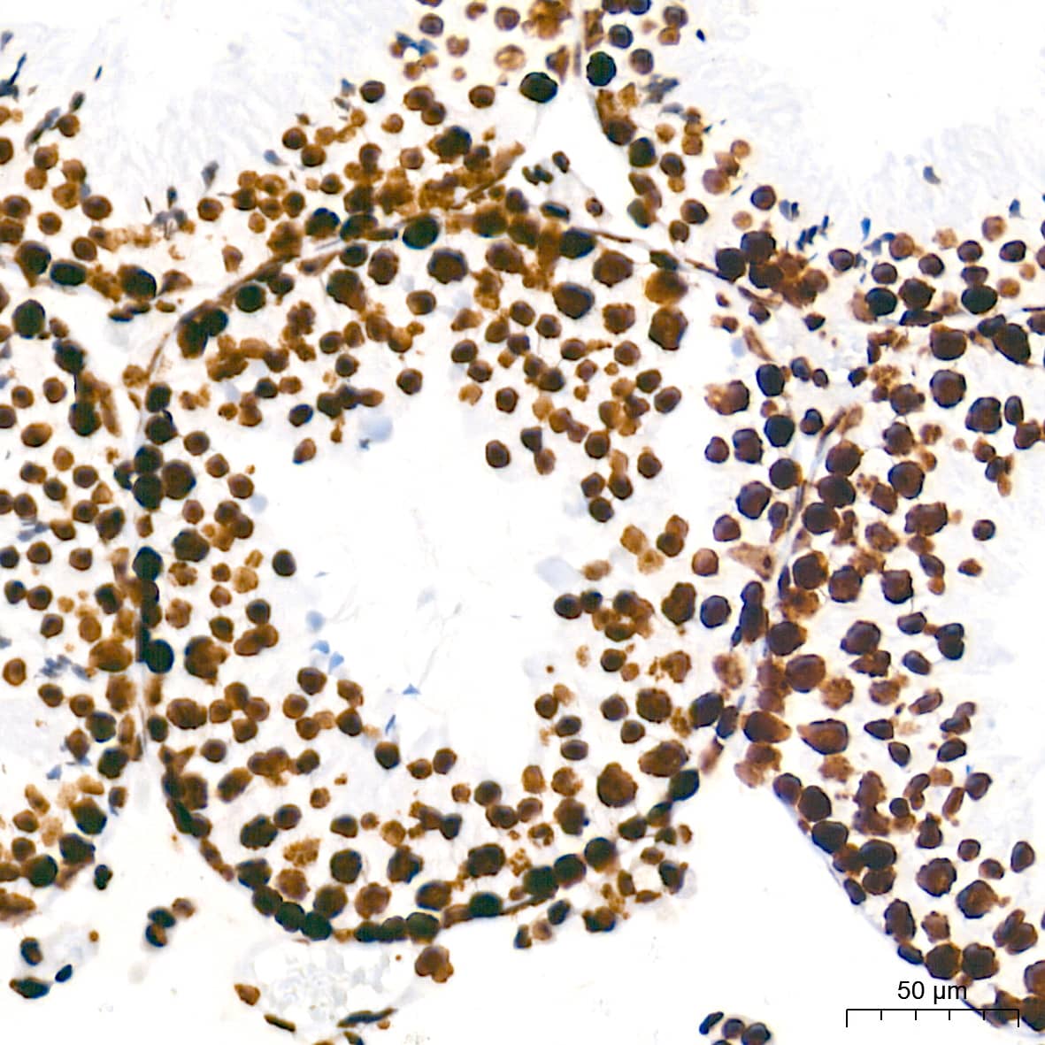 Immunohistochemistry HMGA1 Antibody (5J0E6)