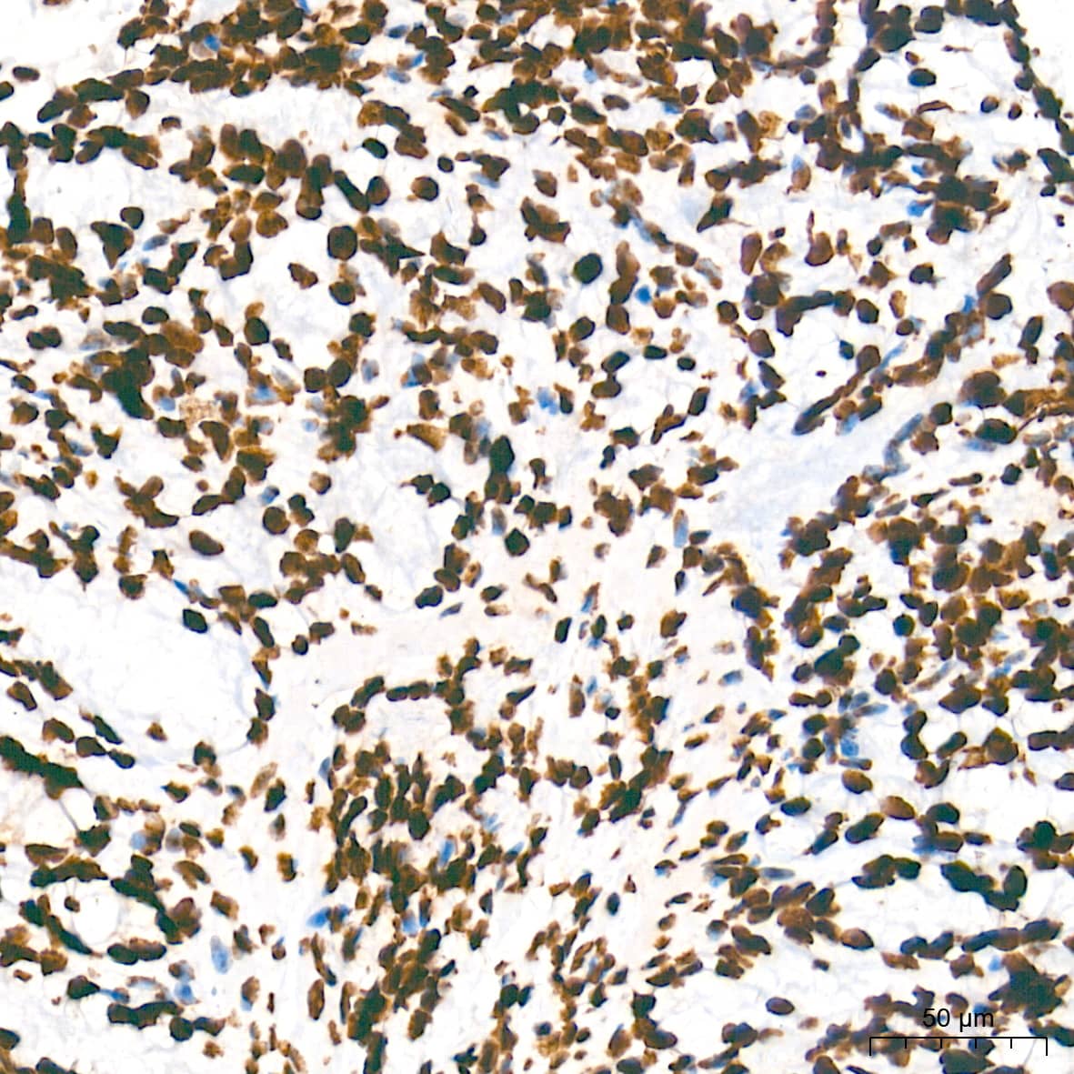 Immunohistochemistry: HMGA1 Antibody (5J0E6) [NBP3-16379] - Immunohistochemistry analysis of paraffin-embedded Mouse colon tissue using HMGA1 Rabbit mAb at a dilution of 1:5000 (40x lens). High pressure antigen retrieval performed with 0.01M Tris-EDTA Buffer (pH 9.0) prior to IHC staining.