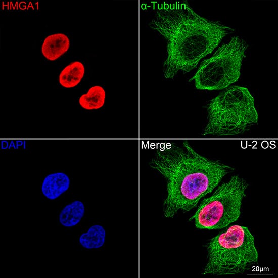 Immunocytochemistry/ Immunofluorescence: HMGA1 Antibody (5J0E6) [NBP3-16379] - Confocal imaging of U-2 OS cells using HMGA1 Rabbit mAb. The cells were counterstained with alpha-Tubulin Mouse mAb (Green). DAPI was used for nuclear staining (blue). Objective: 100x.