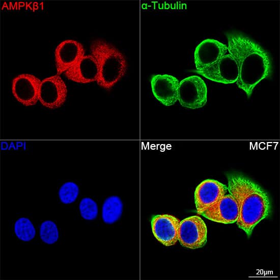 Immunocytochemistry/ Immunofluorescence: AMPK beta 1 Antibody (7G8U1) [NBP3-16380] - Confocal imaging of MCF7 cells using AMPK beta 1 Rabbit mAb. The cells were counterstained with alpha-Tubulin Mouse mAb (Green). DAPI was used for nuclear staining (blue). Objective: 100x.