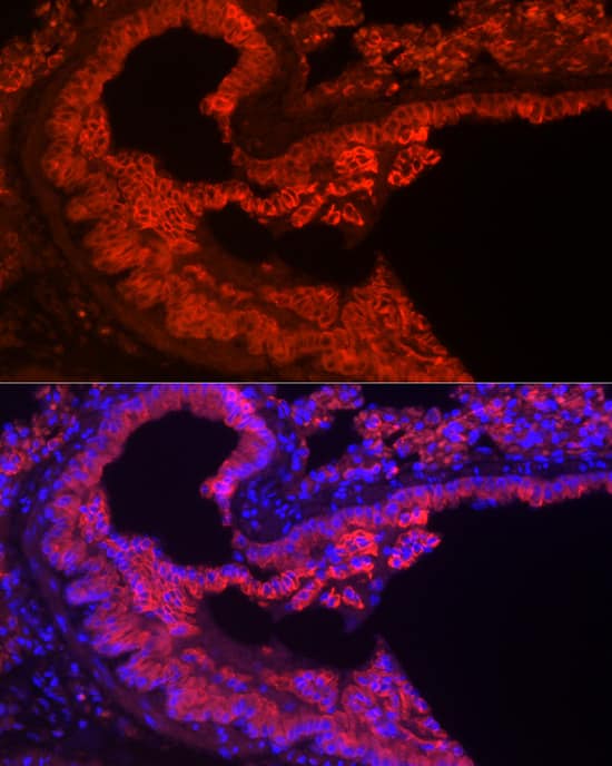 Immunocytochemistry/ Immunofluorescence: Cytokeratin 7 Antibody (5V4M10) [NBP3-16388] - Immunofluorescence analysis of paraffin-embedded Mouse lung tissue using Cytokeratin 7 Rabbit mAb at dilution of 1:50 (40x lens). Secondary antibody: Cy3-conjugated Goat anti-Rabbit IgG (H+L) at 1:500 dilution. Blue: DAPI for nuclear staining.