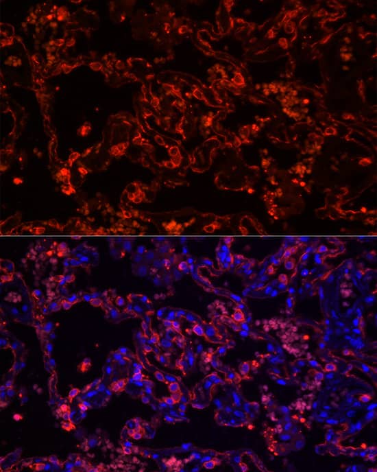 Immunocytochemistry/ Immunofluorescence: Cytokeratin 7 Antibody (5V4M10) [NBP3-16388] - Immunofluorescence analysis of paraffin-embedded Human lung tissue using Cytokeratin 7 Rabbit mAb at dilution of 1:50 (40x lens). Secondary antibody: Cy3-conjugated Goat anti-Rabbit IgG (H+L) at 1:500 dilution. Blue: DAPI for nuclear staining.