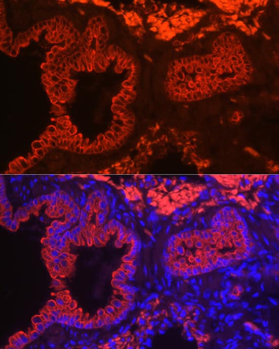 Immunocytochemistry/ Immunofluorescence: Cytokeratin 7 Antibody (5V4M10) [NBP3-16388] - Immunofluorescence analysis of paraffin-embedded Rat lung tissue using Cytokeratin 7 Rabbit mAb at dilution of 1:50 (40x lens). Secondary antibody: Cy3-conjugated Goat anti-Rabbit IgG (H+L) at 1:500 dilution. Blue: DAPI for nuclear staining.