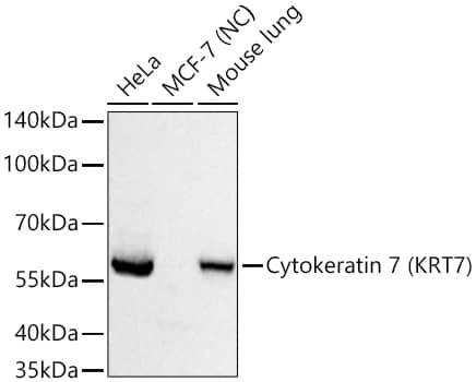 Western Blot: Cytokeratin 7 Antibody (5V4M10) [NBP3-16388] - Western blot analysis of various lysates using Cytokeratin 7 Rabbit mAb at 1:20000 dilution incubated at room temperature for 1.5 hours.Secondary antibody: HRP-conjugated Goat anti-Rabbit IgG (H+L) at 1:10000 dilution.Lysates/proteins: 25 ug per lane.Blocking buffer: 3% nonfat dry milk in TBST.Detection: ECL Basic Kit.Negative control (NC): MCF-7Exposure time: 1s.