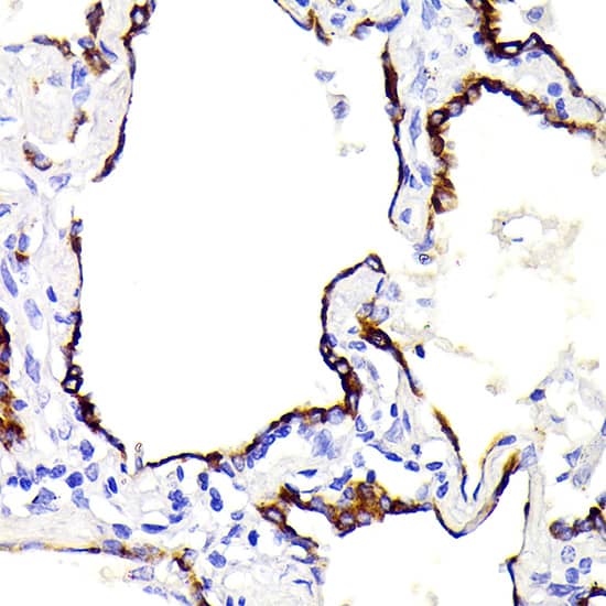 Immunohistochemistry: Cytokeratin 7 Antibody (5V4M10) [NBP3-16388] - Immunohistochemistry analysis of paraffin-embedded Human lung using Cytokeratin 7 Rabbit mAb at dilution of 1:100 (40x lens). Microwave antigen retrieval performed with 0.01M PBS Buffer (pH 7.2) prior to IHC staining.