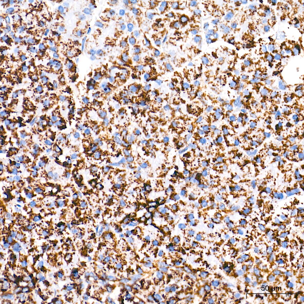Immunohistochemistry: UQCRC2 Antibody (3E3O8) [NBP3-16390] - Immunohistochemistry analysis of paraffin-embedded Human pancreas tissue using UQCRC2 Rabbit mAb at a dilution of 1:500 (40x lens). High pressure antigen retrieval performed with 0.01M Tris-EDTA Buffer (pH 9.0) prior to IHC staining.