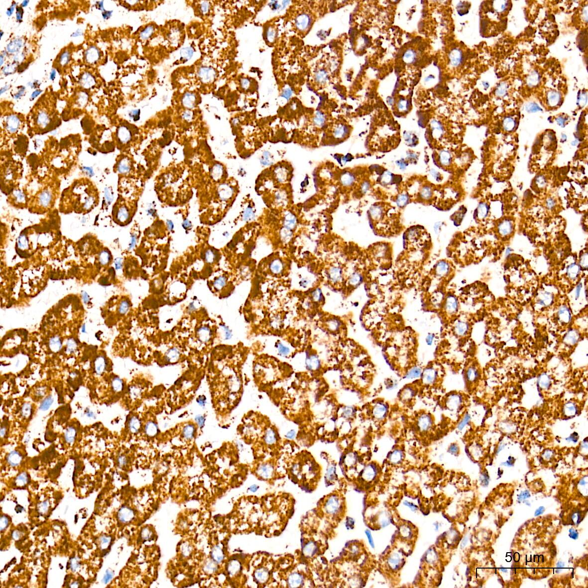 Immunohistochemistry: UQCRC2 Antibody (3E3O8) [NBP3-16390] - Immunohistochemistry analysis of paraffin-embedded Human liver tissue using UQCRC2 Rabbit mAb at a dilution of 1:500 (40x lens). High pressure antigen retrieval performed with 0.01M Tris-EDTA Buffer (pH 9.0) prior to IHC staining.