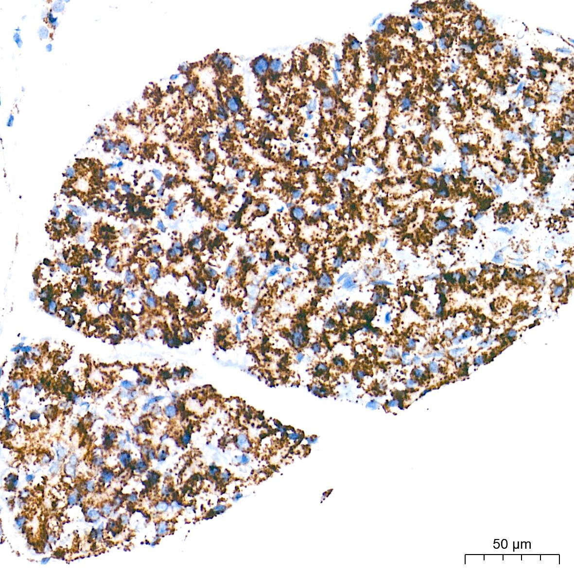 Immunohistochemistry: UQCRC2 Antibody (3E3O8) [NBP3-16390] - Immunohistochemistry analysis of paraffin-embedded Rat pancreas tissue using UQCRC2 Rabbit mAb at a dilution of 1:500 (40x lens). High pressure antigen retrieval performed with 0.01M Tris-EDTA Buffer (pH 9.0) prior to IHC staining.