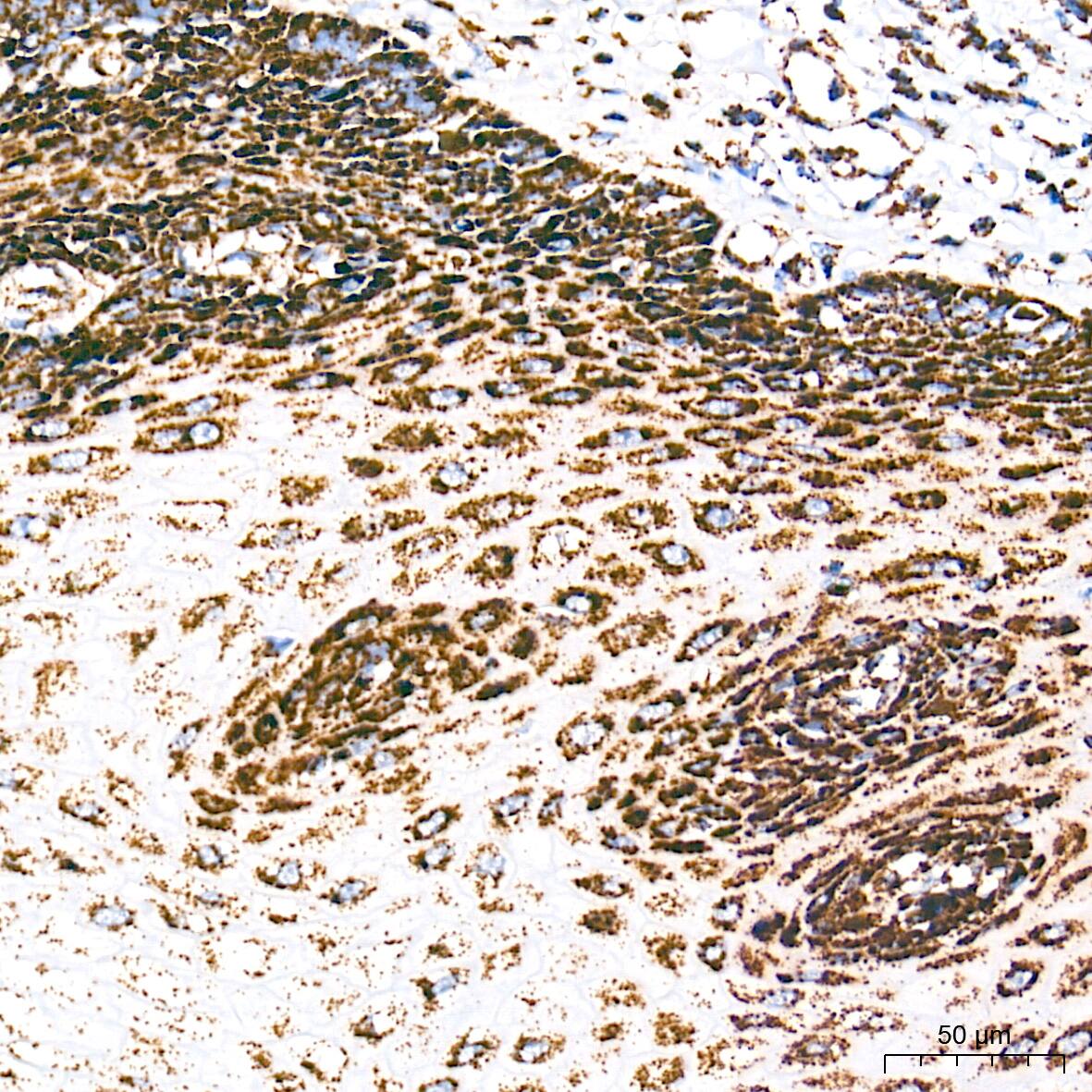 Immunohistochemistry: UQCRC2 Antibody (3E3O8) [UQCRC2] - Immunohistochemistry analysis of paraffin-embedded Human esophagus tissue using UQCRC2 Rabbit mAb  at a dilution of 1:500 (40x lens). High pressure antigen retrieval performed with 0.01M Tris-EDTA Buffer (pH 9.0) prior to IHC staining.