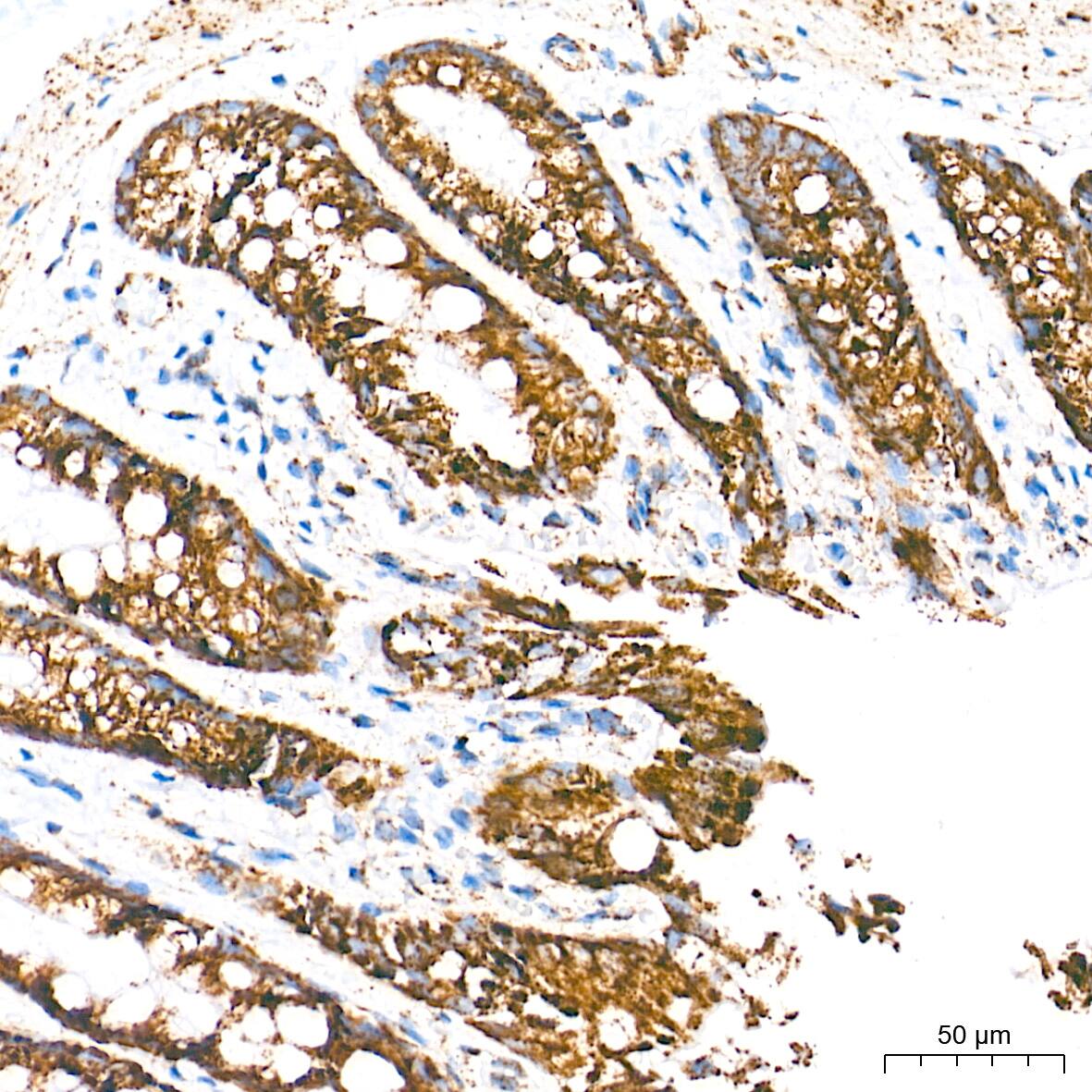 Immunohistochemistry: UQCRC2 Antibody (3E3O8) [UQCRC2] - Immunohistochemistry analysis of paraffin-embedded Rat colon tissue using UQCRC2 Rabbit mAb  at a dilution of 1:500 (40x lens). High pressure antigen retrieval performed with 0.01M Tris-EDTA Buffer (pH 9.0) prior to IHC staining.