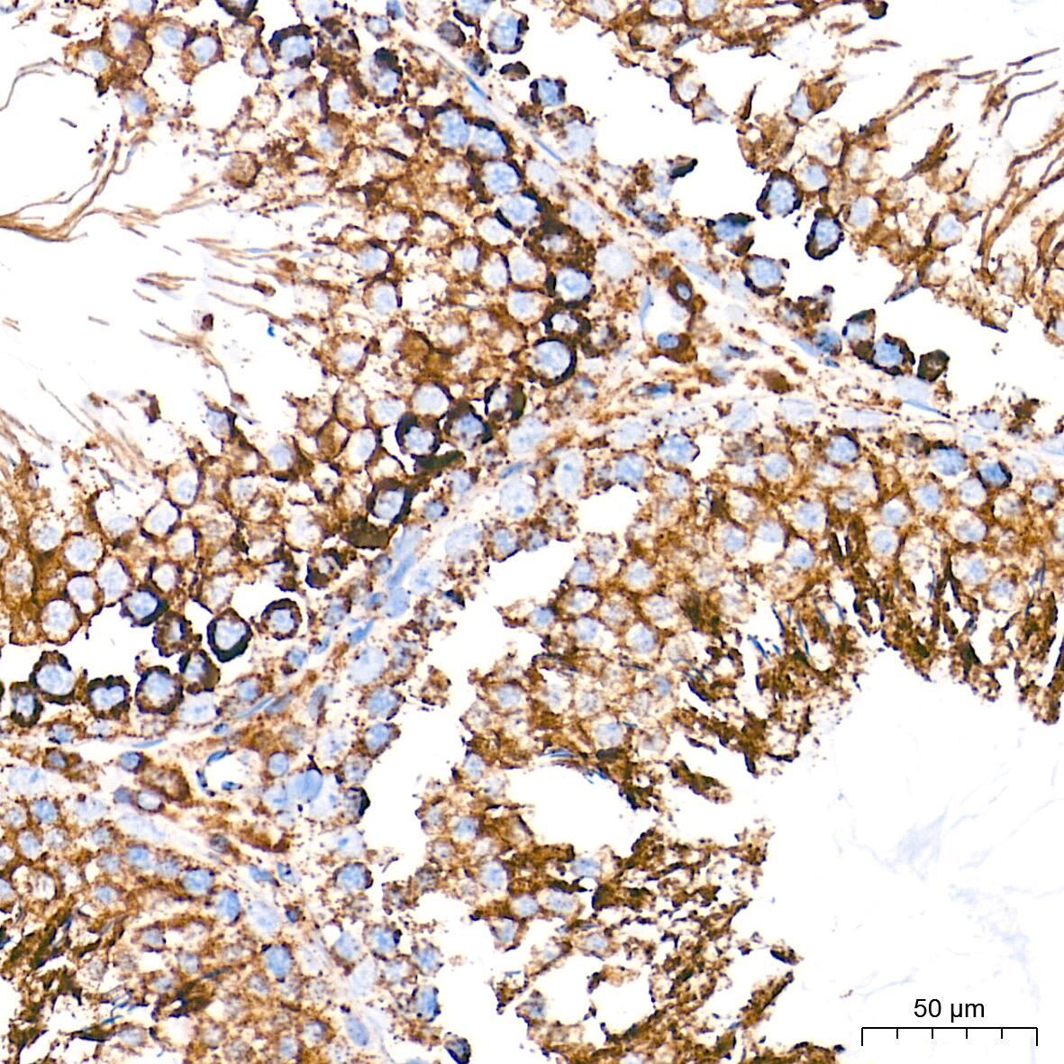 Immunohistochemistry: UQCRC2 Antibody (3E3O8) [UQCRC2] - Immunohistochemistry analysis of paraffin-embedded Rat testis tissue using UQCRC2 Rabbit mAb  at a dilution of 1:500 (40x lens). High pressure antigen retrieval performed with 0.01M Tris-EDTA Buffer (pH 9.0) prior to IHC staining.