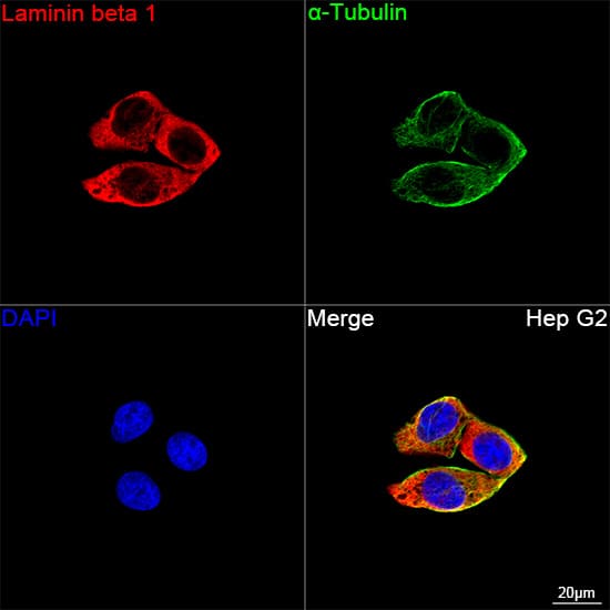 Immunocytochemistry/ Immunofluorescence: Laminin beta 1 Antibody (6I9T4) [NBP3-16392] - Confocal imaging of Hep G2 cells using Laminin beta 1 Rabbit mAb followed by a further incubation with Cy3 Goat Anti-Rabbit IgG (H+L) . The cells were counterstained with alpha-Tubulin Mouse mAb followed by incubation with ABflo(R) 488-conjugated Goat Anti-Mouse IgG (H+L) Ab (Green). DAPI was used for nuclear staining (Blue). Objective: 100x.