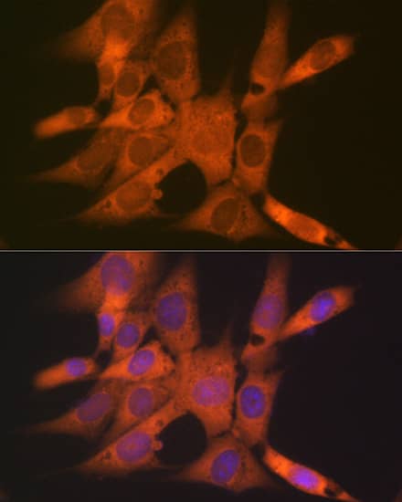 Immunocytochemistry/ Immunofluorescence: CLEC3B/Tetranectin Antibody (3E5Y7) [NBP3-16399] - Immunofluorescence analysis of NIH-3T3 cells using CLEC3B/CLEC3B/Tetranectin Rabbit mAb  at dilution of 1:100 (40x lens). Blue: DAPI for nuclear staining.