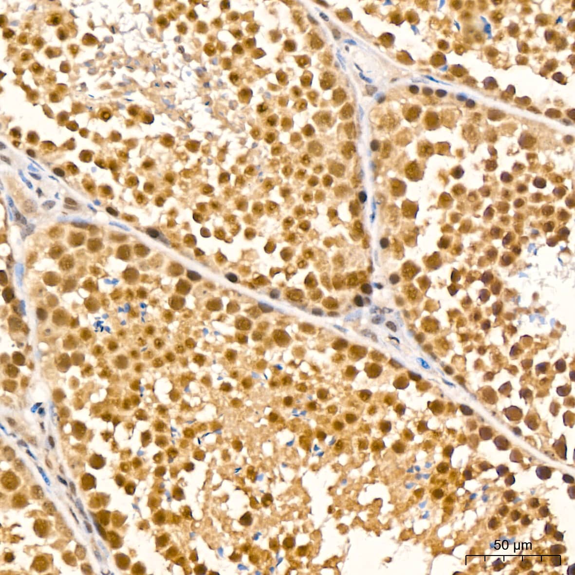 Immunohistochemistry: UBE2I/Ubc9 Antibody (6Z9V6) [NBP3-16400] - Immunohistochemistry analysis of UBE2I/Ubc9 in paraffin-embedded mouse testis tissue using UBE2I/Ubc9 Rabbit mAb  at a dilution of 1:200 (40x lens).High pressure antigen retrieval was performed with 0.01 M citrate buffer (pH 6.0) prior to IHC staining.