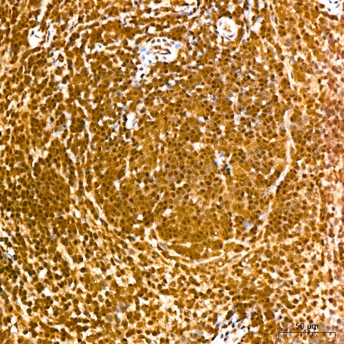Immunohistochemistry: UBE2I/Ubc9 Antibody (6Z9V6) [NBP3-16400] - Immunohistochemistry analysis of UBE2I/Ubc9 in paraffin-embedded mouse spleen tissue using UBE2I/Ubc9 Rabbit mAb  at a dilution of 1:200 (40x lens).High pressure antigen retrieval was performed with 0.01 M citrate buffer (pH 6.0) prior to IHC staining.