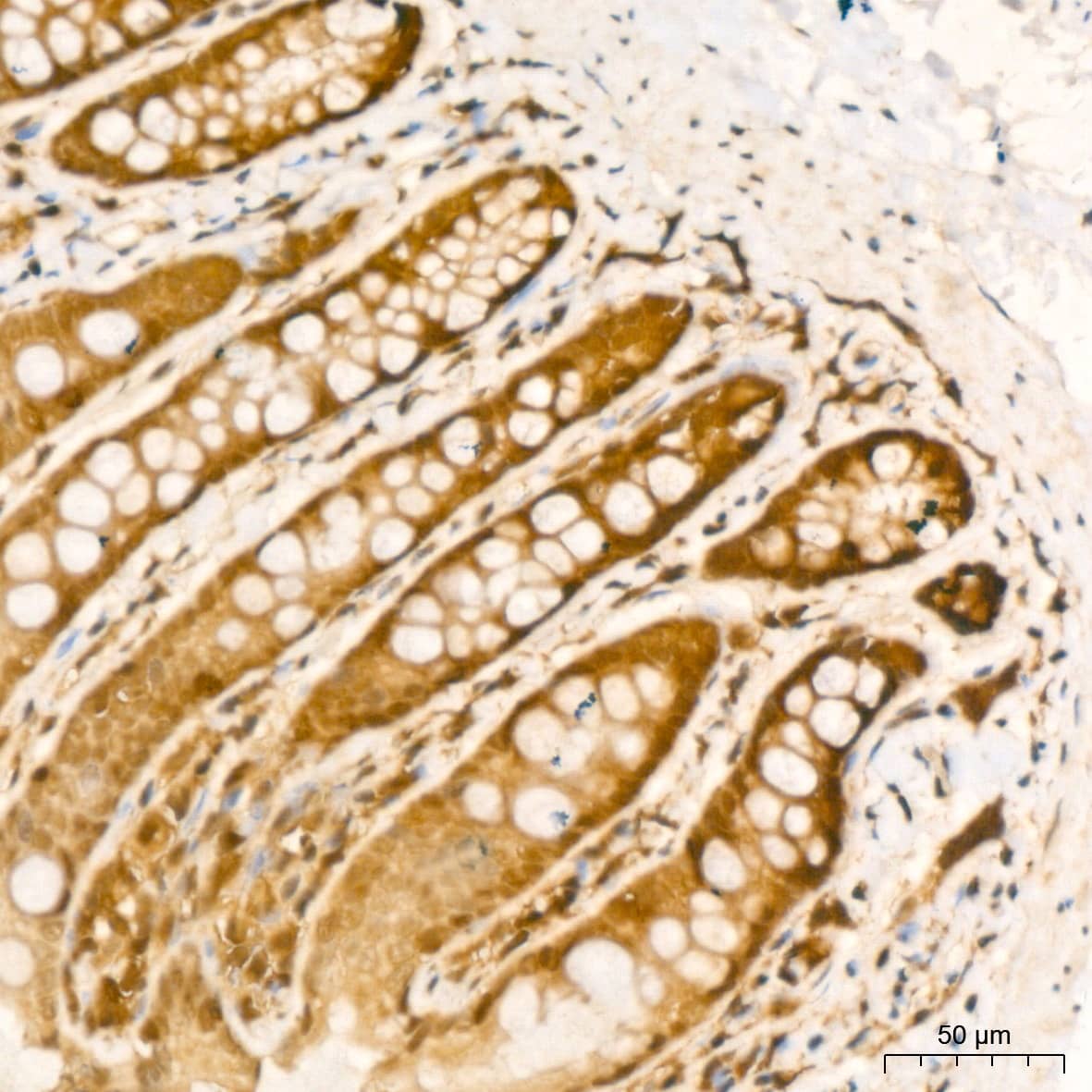 Immunohistochemistry: UBE2I/Ubc9 Antibody (6Z9V6) [NBP3-16400] - Immunohistochemistry analysis of UBE2I/Ubc9 in paraffin-embedded rat colon tissue using UBE2I/Ubc9 Rabbit mAb  at a dilution of 1:200 (40x lens).High pressure antigen retrieval was performed with 0.01 M citrate buffer (pH 6.0) prior to IHC staining.