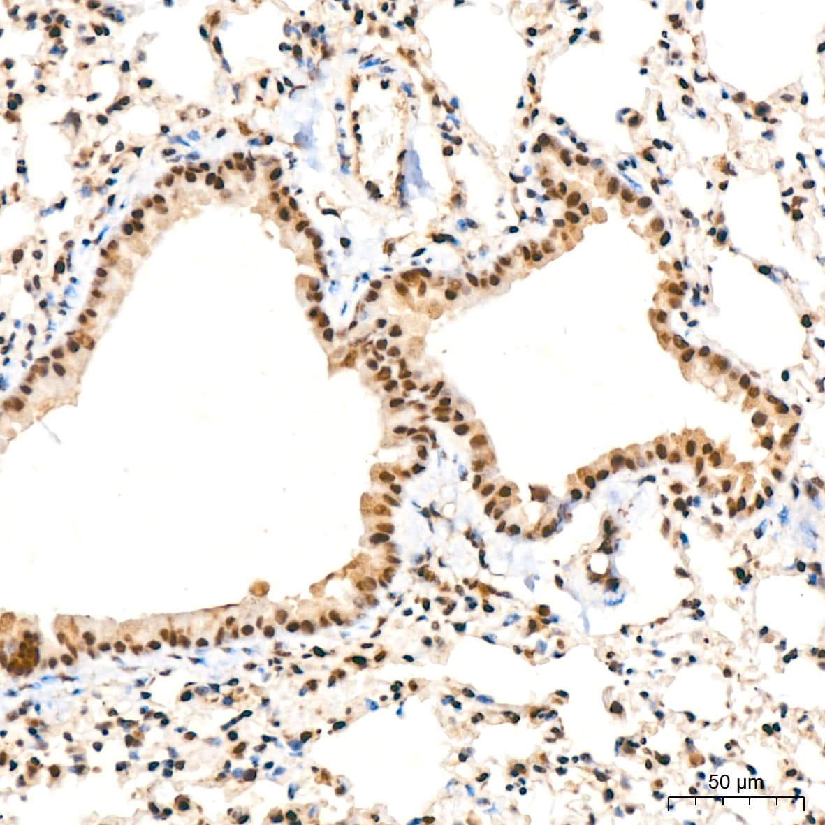 Immunohistochemistry: UBE2I/Ubc9 Antibody (6Z9V6) [NBP3-16400] - Immunohistochemistry analysis of UBE2I/Ubc9 in paraffin-embedded mouse lung tissue using UBE2I/Ubc9 Rabbit mAb  at a dilution of 1:200 (40x lens).High pressure antigen retrieval was performed with 0.01 M citrate buffer (pH 6.0) prior to IHC staining.