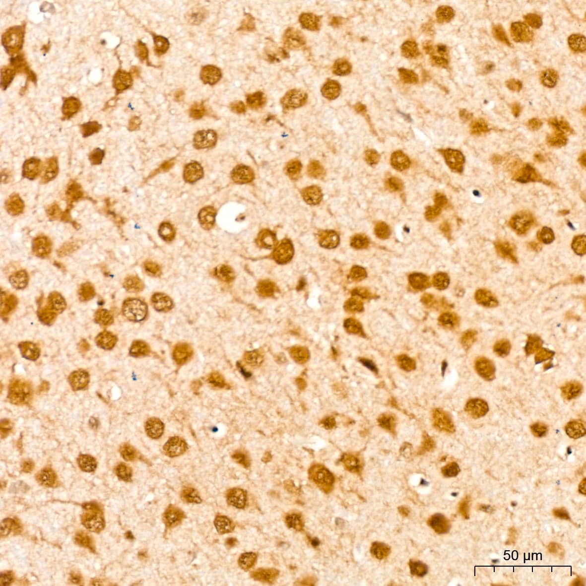 Immunohistochemistry: UBE2I/Ubc9 Antibody (6Z9V6) [NBP3-16400] - Immunohistochemistry analysis of UBE2I/Ubc9 in paraffin-embedded mouse brain tissue using UBE2I/Ubc9 Rabbit mAb  at a dilution of 1:200 (40x lens).High pressure antigen retrieval was performed with 0.01 M citrate buffer (pH 6.0) prior to IHC staining.