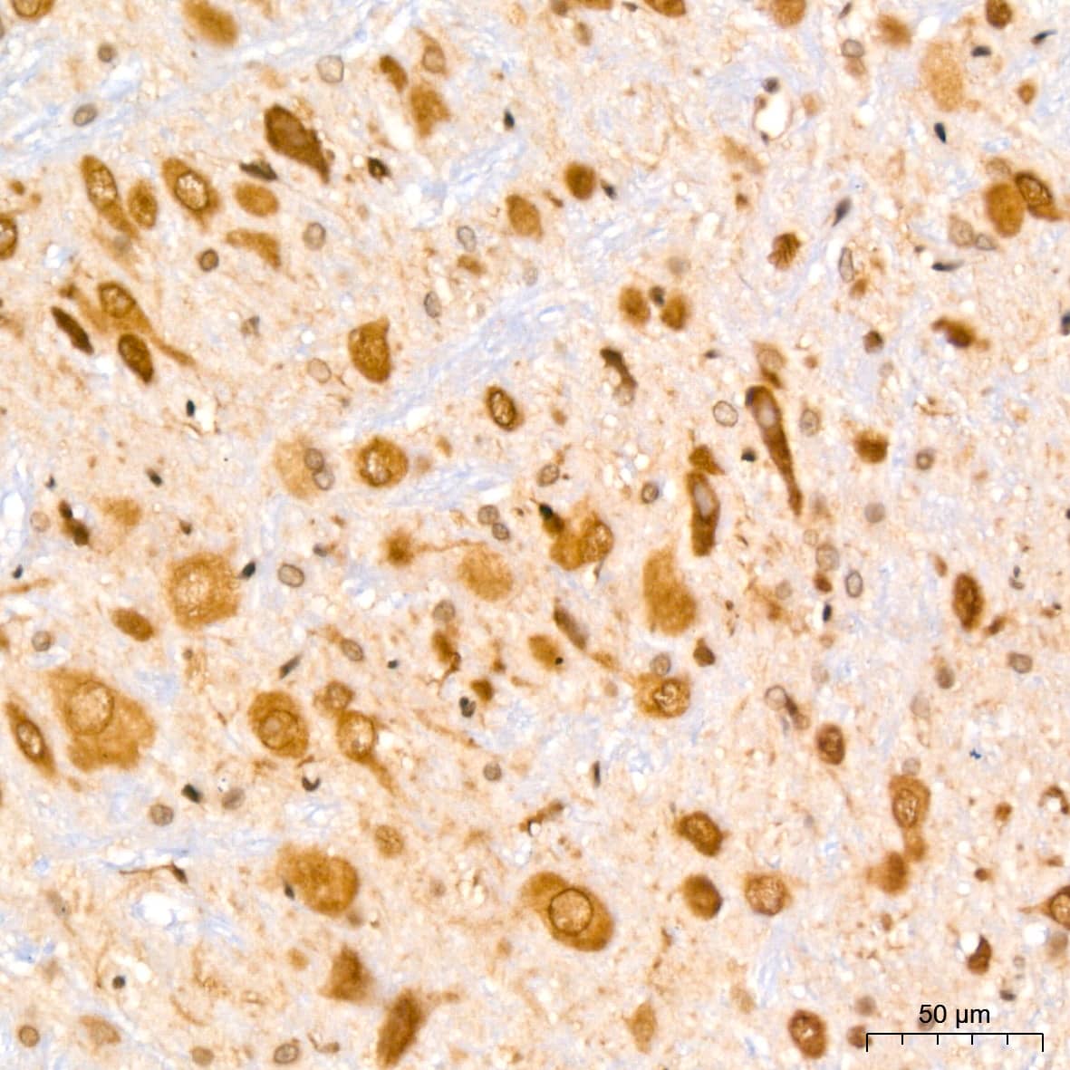 Immunohistochemistry: UBE2I/Ubc9 Antibody (6Z9V6) [NBP3-16400] - Immunohistochemistry analysis of UBE2I/Ubc9 in paraffin-embedded rat brain tissue using UBE2I/Ubc9 Rabbit mAb  at a dilution of 1:200 (40x lens).High pressure antigen retrieval was performed with 0.01 M citrate buffer (pH 6.0) prior to IHC staining.