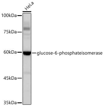 <b>Genetic Strategies Validation. </b>Western Blot: Glucose 6 phosphate isomerase Antibody (2Y8R0) [NBP3-16401] - Western blot analysis of lysates from HeLa cells, using [KD Validated] glucose-6-phosphateisomerase Rabbit mAb at 1:1000 dilution.Secondary antibody: HRP Goat Anti-Rabbit IgG (H+L) at 1:10000 dilution.Lysates/proteins: 25ug per lane.Blocking buffer: 3% nonfat dry milk in TBST.Detection: ECL Basic Kit.Exposure time: 60s.