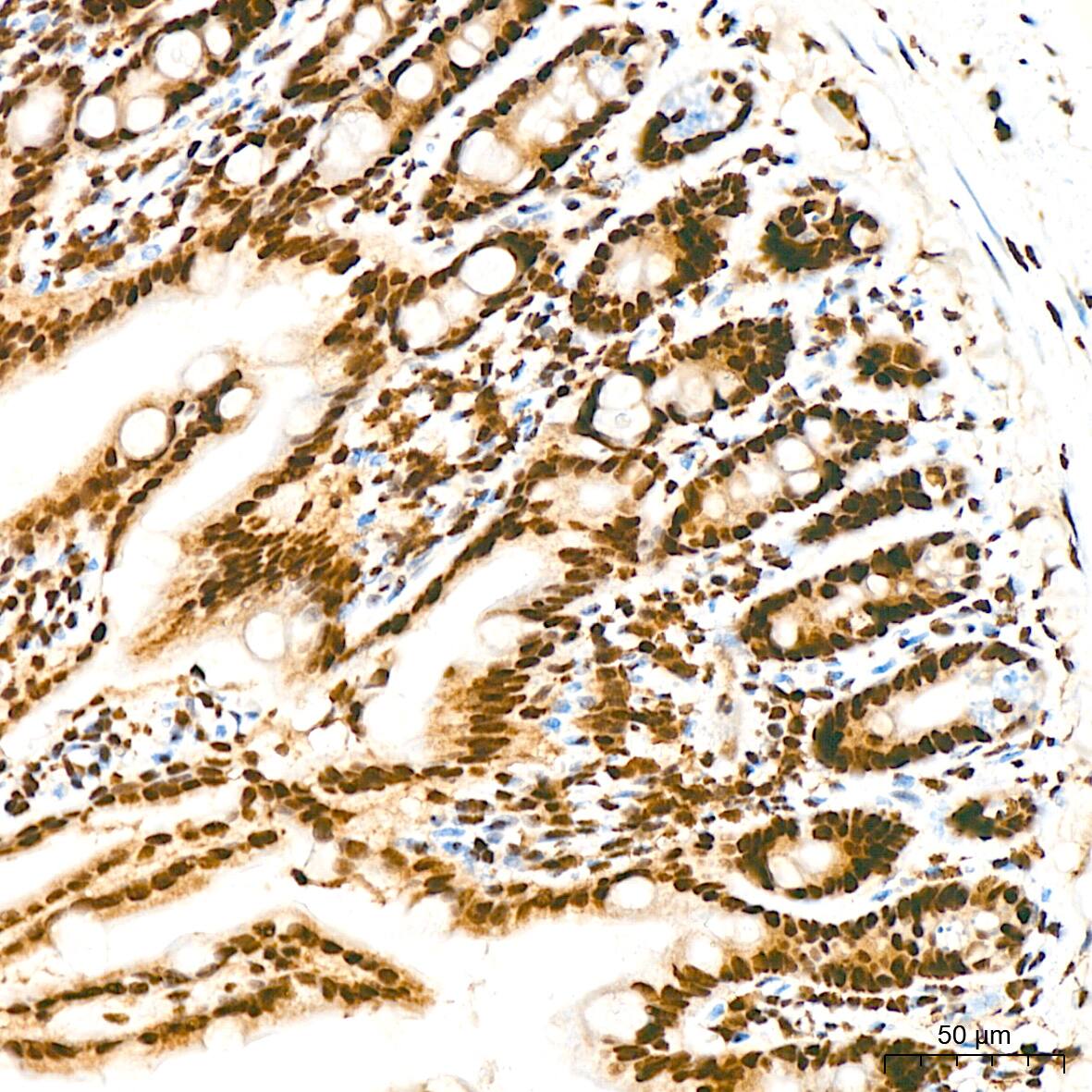 Immunohistochemistry: DKC1 Antibody (2W2V6) [NBP3-16405] - Immunohistochemistry analysis of DKC1 in paraffin-embedded mouse colon tissue using DKC1 Rabbit mAb  at a dilution of 1:200 (40x lens). High pressure antigen retrieval was performed with 0.01 M citrate buffer (pH 6.0) prior to IHC staining.