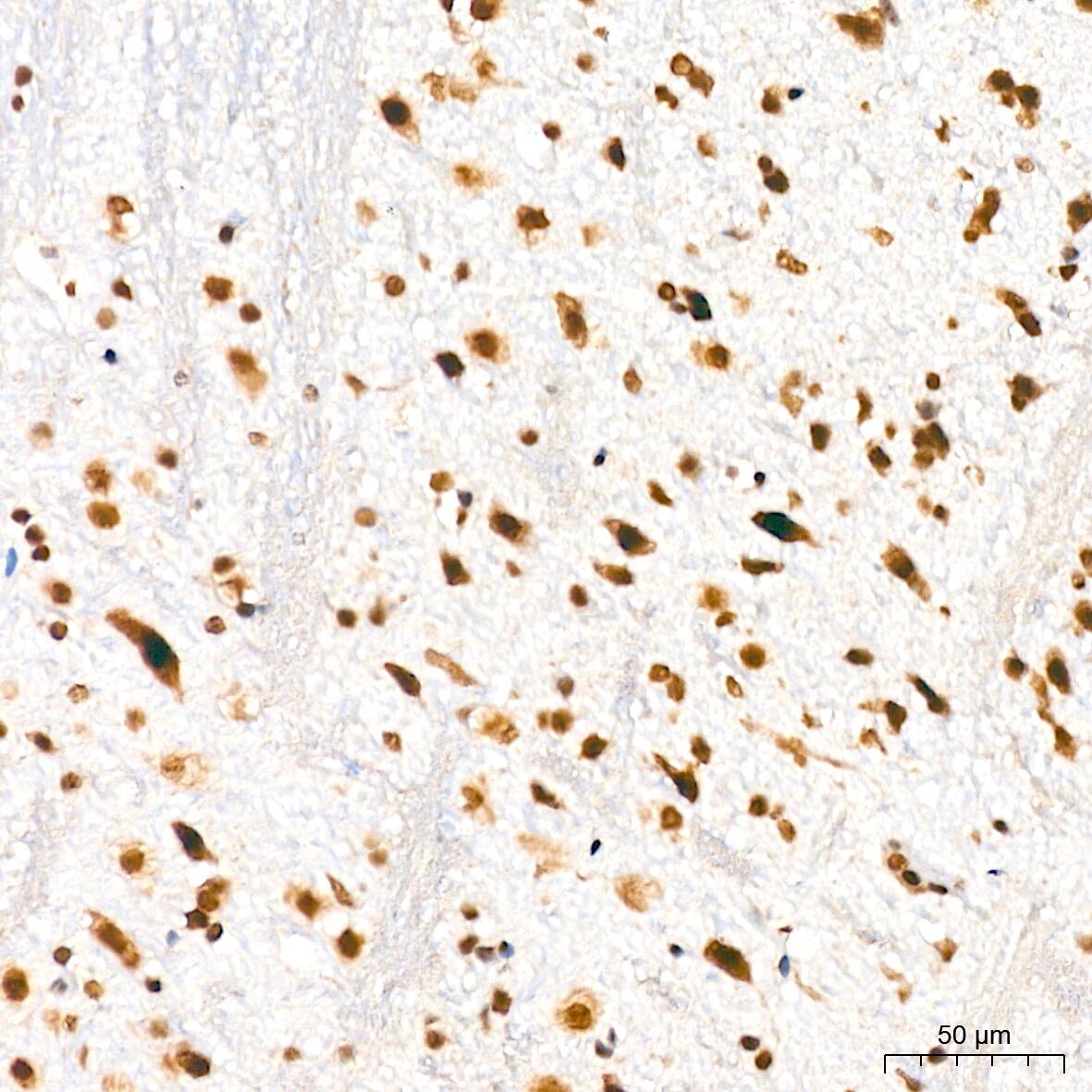 Immunohistochemistry: DKC1 Antibody (2W2V6) [NBP3-16405] - Immunohistochemistry analysis of DKC1 in paraffin-embedded mouse brain tissue using DKC1 Rabbit mAb  at a dilution of 1:200 (40x lens). High pressure antigen retrieval was performed with 0.01 M citrate buffer (pH 6.0) prior to IHC staining.