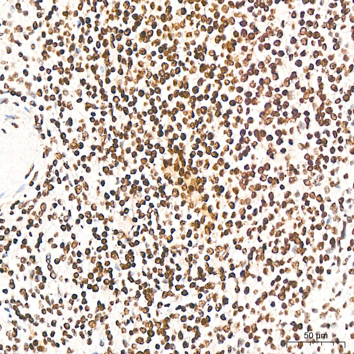 Immunohistochemistry: DKC1 Antibody (2W2V6) [NBP3-16405] - Immunohistochemistry analysis of DKC1 in paraffin-embedded human spleen tissue using DKC1 Rabbit mAb  at a dilution of 1:200 (40x lens). High pressure antigen retrieval was performed with 0.01 M citrate buffer (pH 6.0) prior to IHC staining.