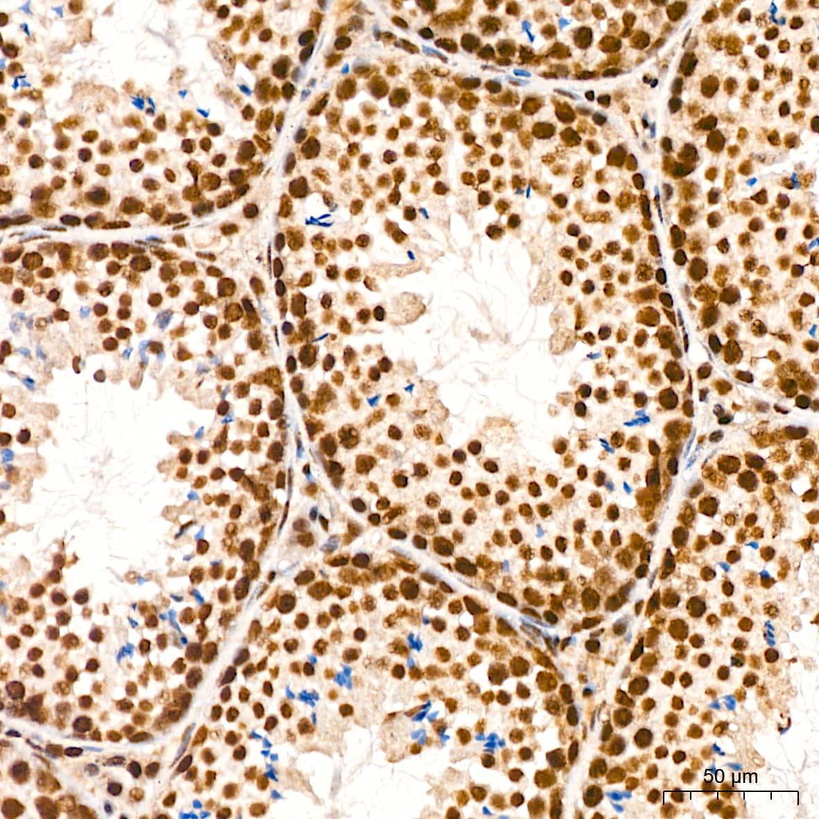 Immunohistochemistry: DKC1 Antibody (2W2V6) [NBP3-16405] - Immunohistochemistry analysis of DKC1 in paraffin-embedded mouse testis tissue using DKC1 Rabbit mAb  at a dilution of 1:200 (40x lens). High pressure antigen retrieval was performed with 0.01 M citrate buffer (pH 6.0) prior to IHC staining.