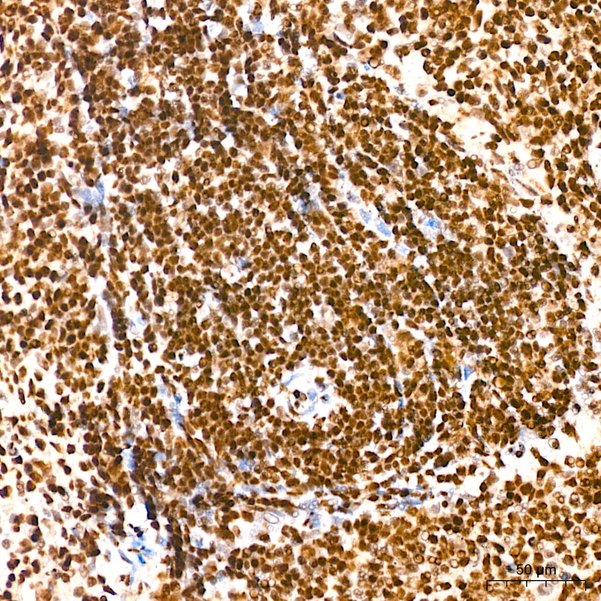 Immunohistochemistry: DKC1 Antibody (2W2V6) [NBP3-16405] - Immunohistochemistry analysis of DKC1 in paraffin-embedded rat spleen tissue using DKC1 Rabbit mAb  at a dilution of 1:200 (40x lens). High pressure antigen retrieval was performed with 0.01 M citrate buffer (pH 6.0) prior to IHC staining.