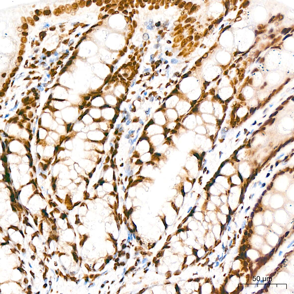 Immunohistochemistry: DKC1 Antibody (2W2V6) [NBP3-16405] - Immunohistochemistry analysis of DKC1 in paraffin-embedded rat colon tissue using DKC1 Rabbit mAb  at a dilution of 1:200 (40x lens). High pressure antigen retrieval was performed with 0.01 M citrate buffer (pH 6.0) prior to IHC staining.