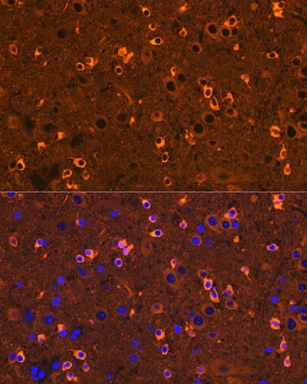 Immunocytochemistry/ Immunofluorescence: CRMP2 Antibody (0A1T1) [NBP3-16406] - Immunofluorescence analysis of mouse brain using CRMP2 Rabbit mAb  at dilution of 1:100 (40x lens). Blue: DAPI for nuclear staining.