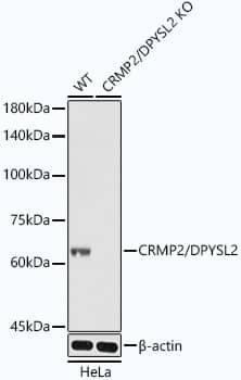 <b>Genetic Strategies Validation. </b>Western Blot: CRMP2 Antibody (0A1T1) [NBP3-16406] - Western blot analysis of extracts from wild type(WT) and CRMP2 knockout (KO) HeLa cells, using CRMP2 antibody  at  1:3000 dilution.Secondary antibody: HRP Goat Anti-Rabbit IgG (H+L)  at 1:10000 dilution.Lysates/proteins: 25ug per lane.Blocking buffer: 3% nonfat dry milk in TBST.Detection: ECL Basic Kit .Exposure time: 1s.