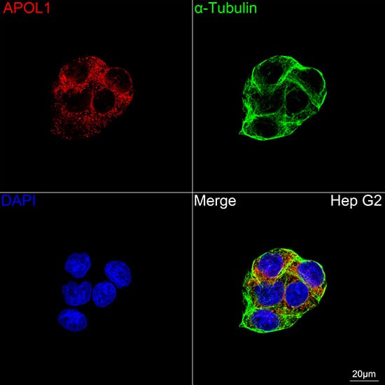 Immunocytochemistry/ Immunofluorescence: Apolipoprotein L1 Antibody (1A8N2) [NBP3-16407] - Confocal imaging of Hep G2 cells using Apolipoprotein L1 Rabbit mAb  followed by a further incubation with Cy3 Goat Anti-Rabbit IgG (H+L)  . The cells were counterstained with alpha-Tubulin Mouse mAb  followed by incubation with ABflo 488-conjugated Goat Anti-Mouse IgG (H+L) Ab  (Green). DAPI was used for nuclear staining (Blue). Objective: 100x.
