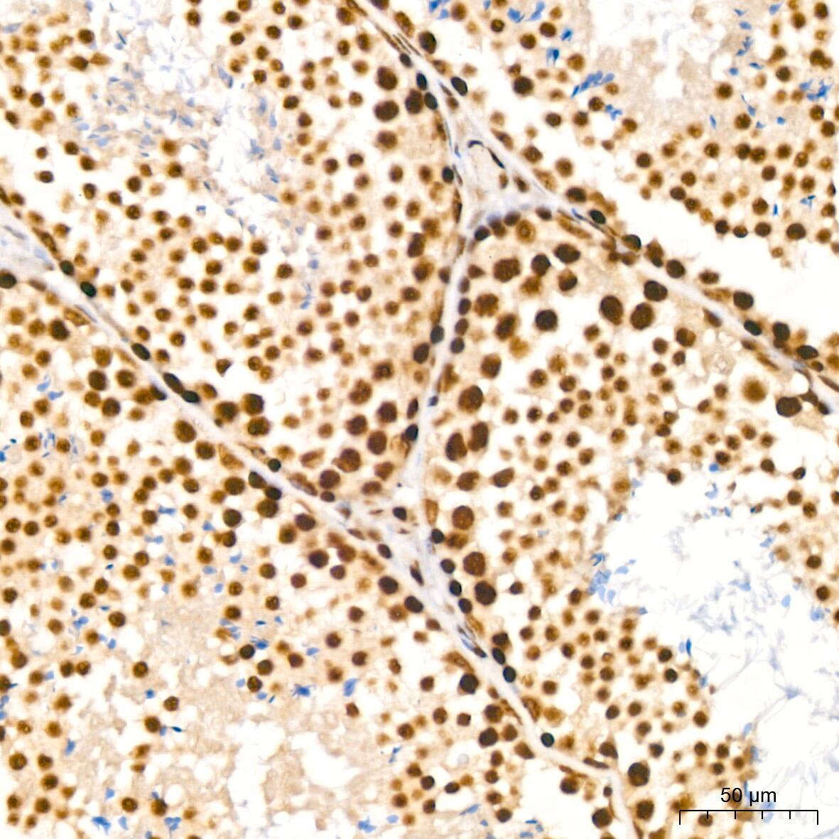 Immunohistochemistry: NuMA Antibody (6D4I4) [NBP3-16411] - Immunohistochemistry analysis of NuMA in paraffin-embedded mouse testis tissue using NuMA Rabbit mAb  at a dilution of 1:200 (40x lens).High pressure antigen retrieval was performed with 0.01 M citrate buffer (pH 6.0) prior to IHC staining.