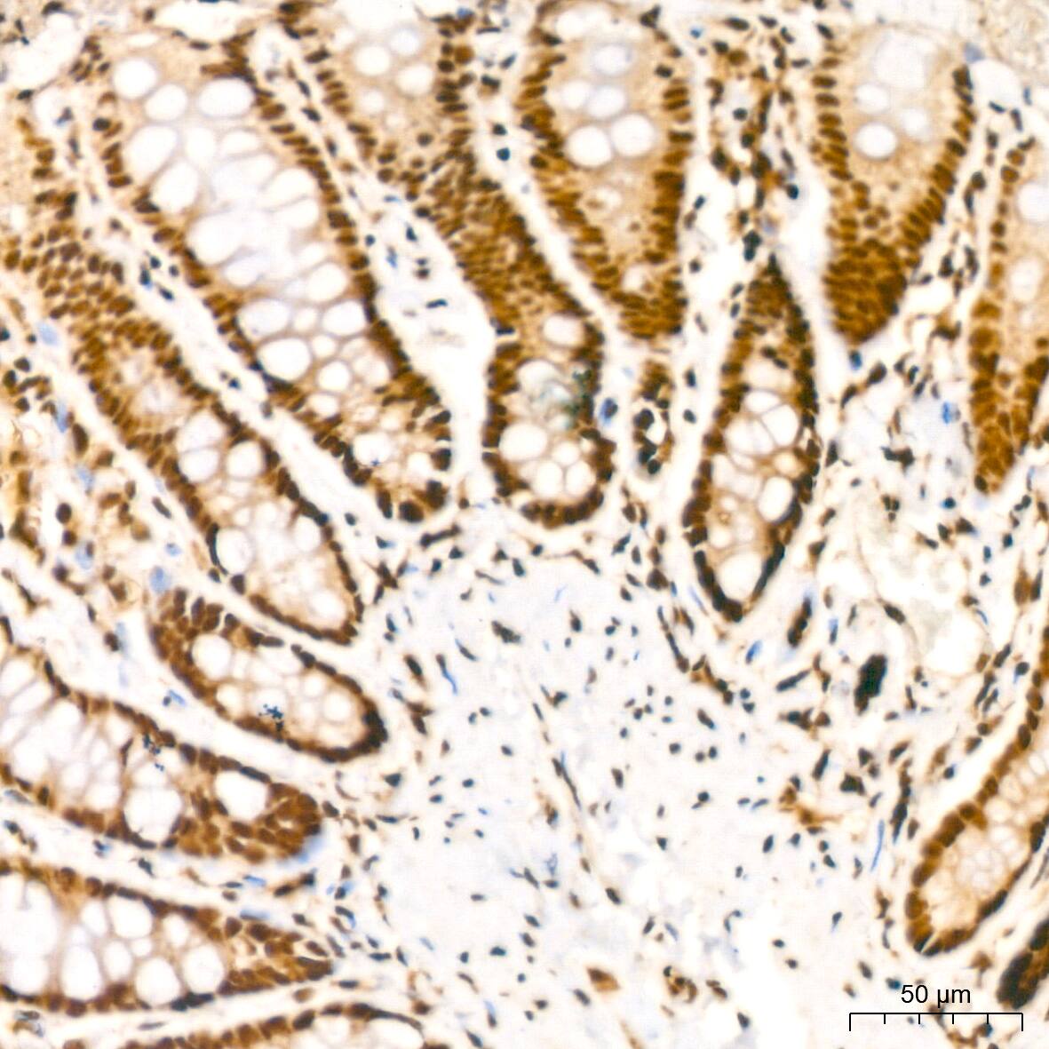 Immunohistochemistry: NuMA Antibody (6D4I4) [NBP3-16411] - Immunohistochemistry analysis of NuMA in paraffin-embedded rat colon tissue using NuMA Rabbit mAb  at a dilution of 1:200 (40x lens).High pressure antigen retrieval was performed with 0.01 M citrate buffer (pH 6.0) prior to IHC staining.